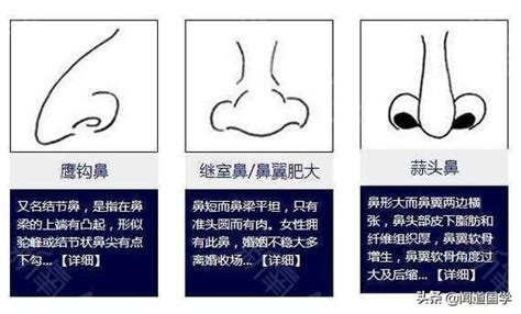 露鼻孔 面相|鼻相分析10款｜鼻樑有節及橫紋、豬膽鼻、鼻頭下垂代表甚麼？姻 